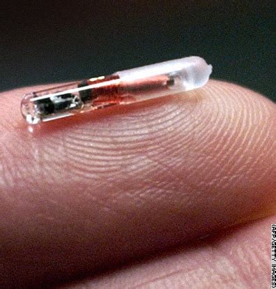 rfid chip implantat mensch|Microchip implant (human) .